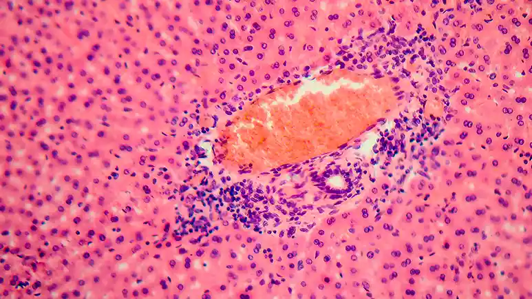 The Sneaky Parasite Puppies Pick Up Fast