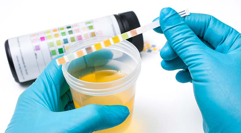 dog urinalysis