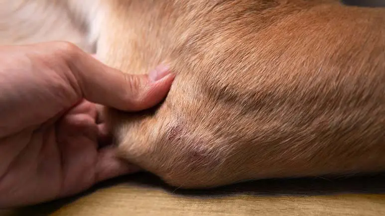 legg calve perthes disease