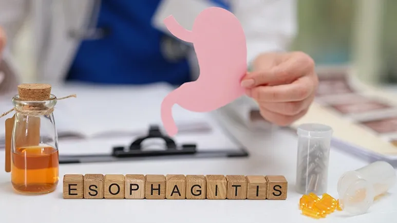 esophagitis