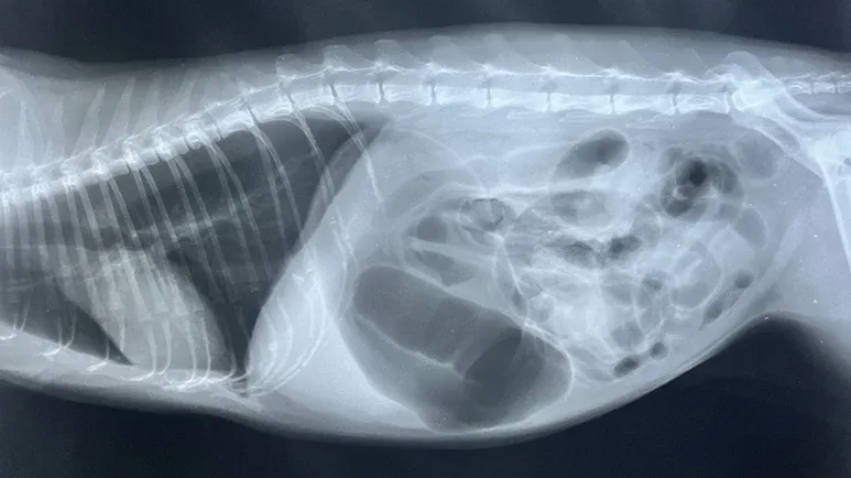 gastric dilatation volvulus