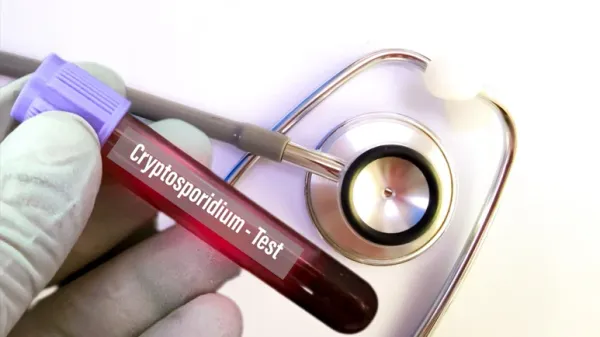cryptosporidiosis