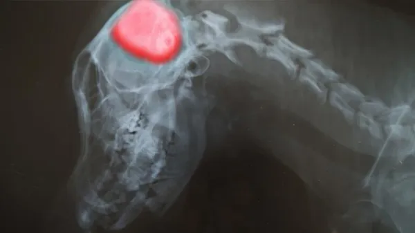dog meningioma